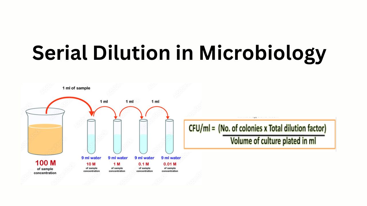 Serial Dilution in Microbiology